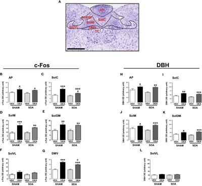 “To brain or not to brain”: evaluating the possible direct effects of the satiety factor oleoylethanolamide in the central nervous system